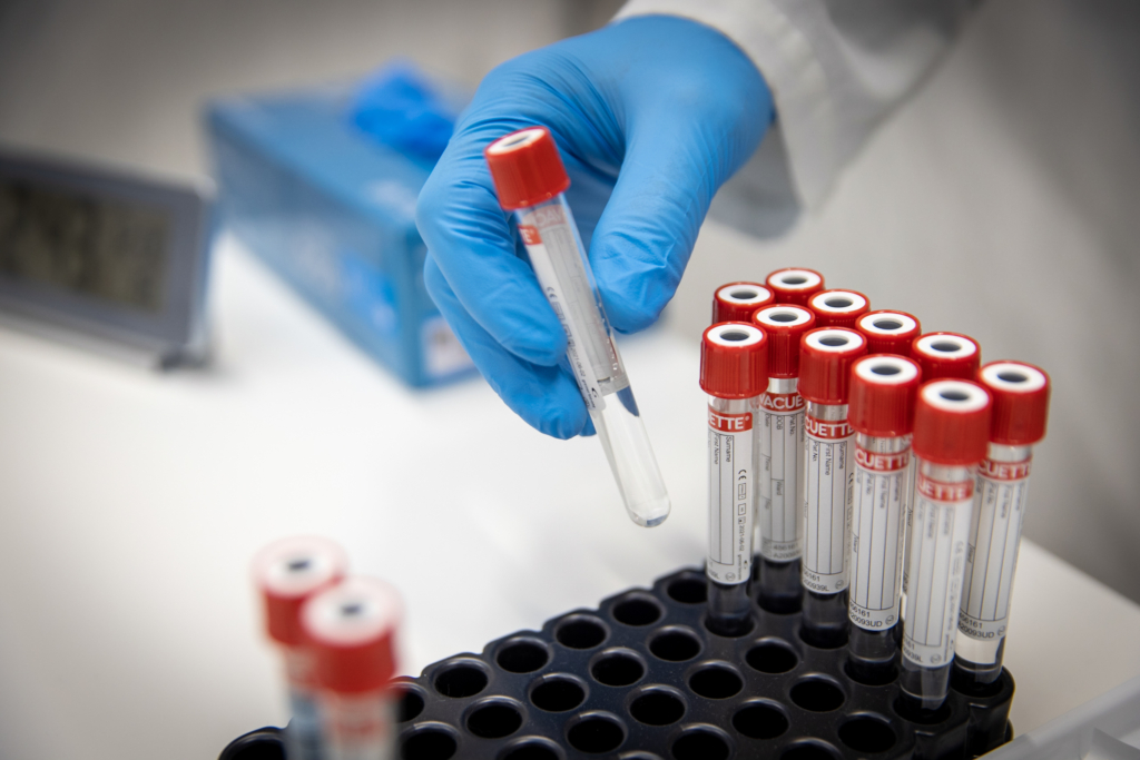 testbuisjes coronatest